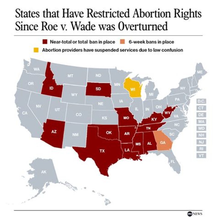 Amy Schumer & More Speak Out About Abortion Rights Amid Roe V. Wade Being Overturned