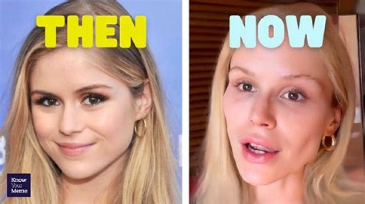 Before & After Photos Showing Their Growth Over Years – Hollywood Life