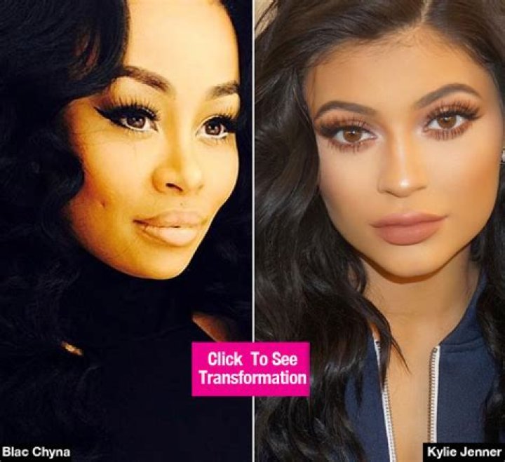 Blac Chyna Getting Plastic Surgery To Look Like Kylie Jenner? Her Doctor Visit