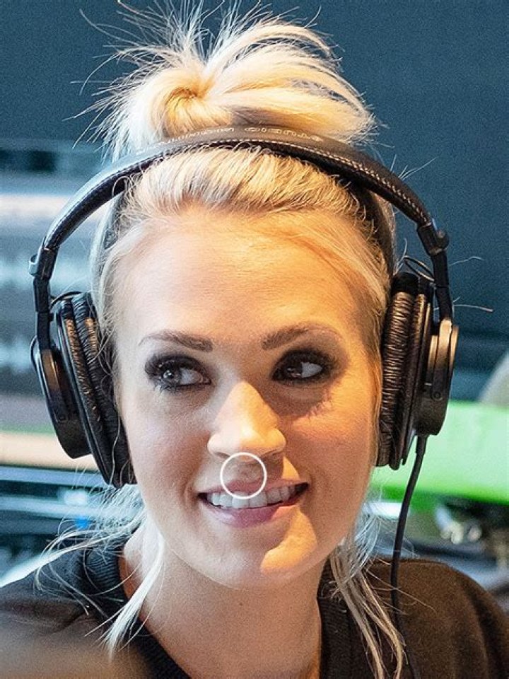 Carrie Underwood’s Scar Looks Like A Shadow, Go Back To Singing – Hollywood Life
