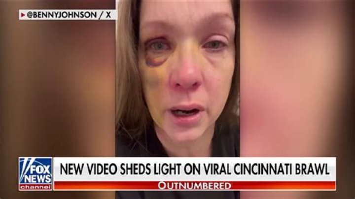 Christy Mack: ‘Horrified’ Friends Support Her After Brutal Attack