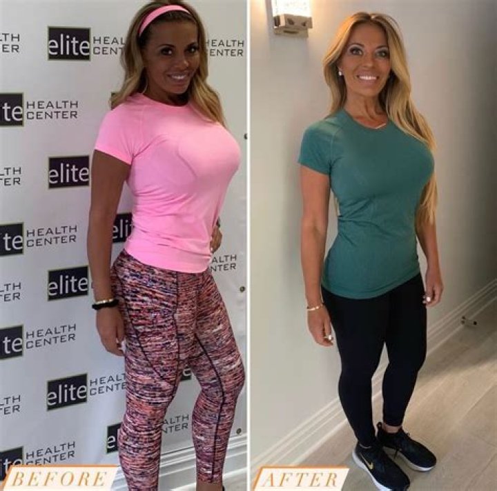 Dolores Catania On Tummy Tuck & Diet That Gave Her Amazing Results – Hollywood Life