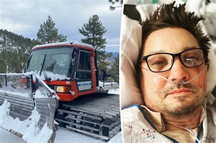 Everything To Know About His Face & The Accident – Hollywood Life