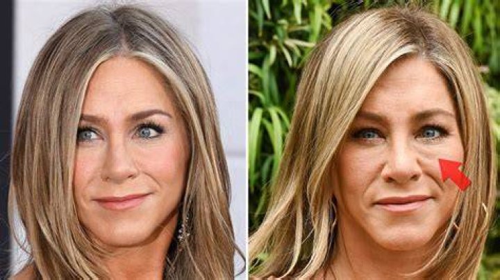 How Celebrities Look Beautiful On Red Carpets: The Injections, Fillers & Facials They Get — Surgeons Speak