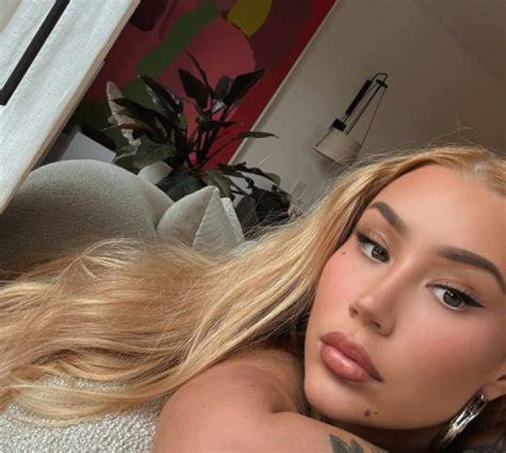 Iggy Azalea Is Unrecognizable With Tighter Face & Plump Lips In New Photo — & Fans Love The Look