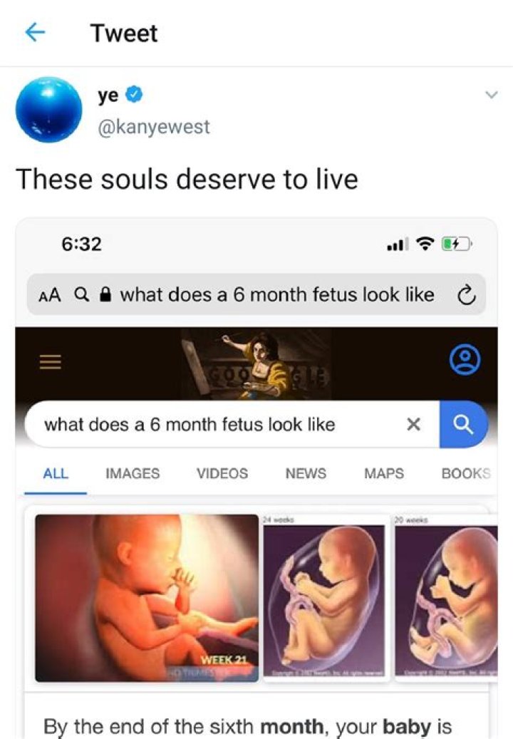 Kanye West Tweets & Deletes Anti-Abortion Message & Fetus Pics: ‘These Souls Deserve To Live’