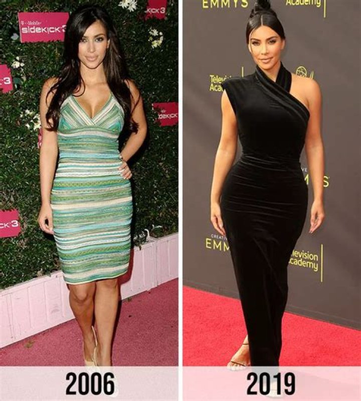 Kim Kardashian: Why It’s Urgent She Works Closely With Her Doc Now That Psoriasis Is On Face
