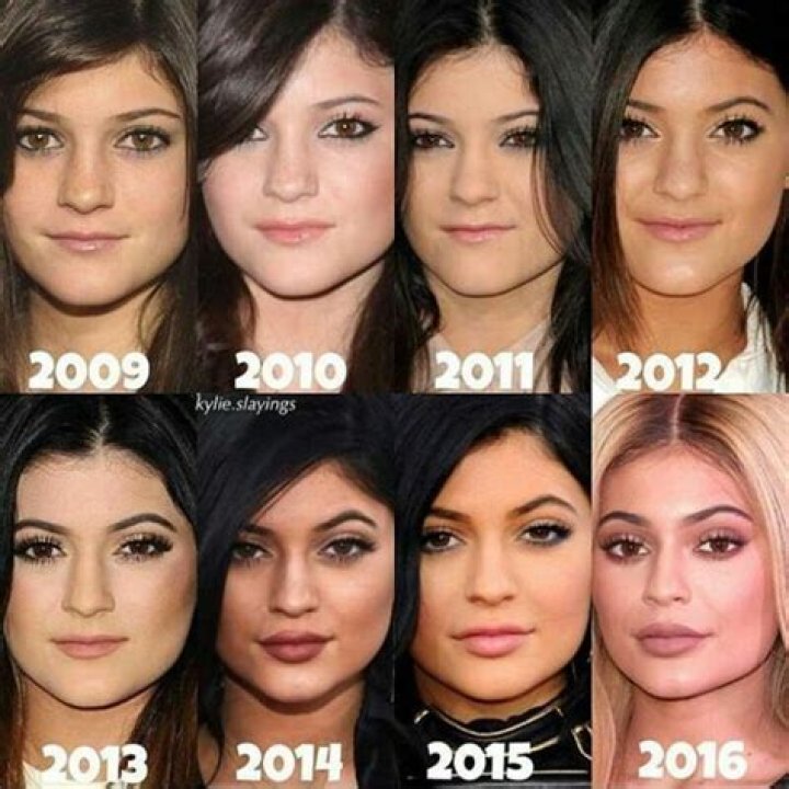 Kylie Jenner’s Beauty Evolution: Pics