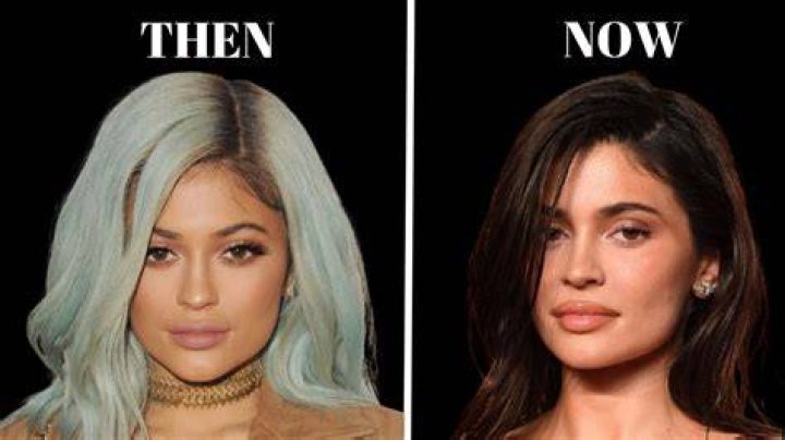 Kylie Jenner Undergoes Lasik Eye Surgery & Celebrates By Throwing A Party