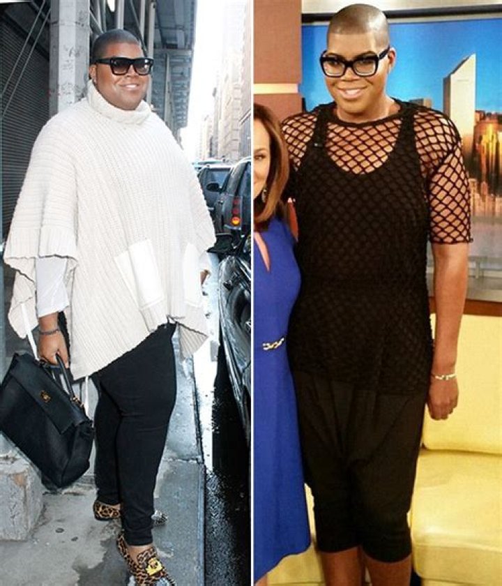 Loses Over 100 lbs After Surgery – Hollywood Life