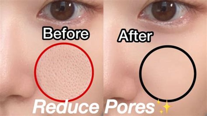 Make Pores Vanish With This Korean Skincare Product – Hollywood Life