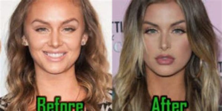 Photos Of Her Changing Lips – Hollywood Life