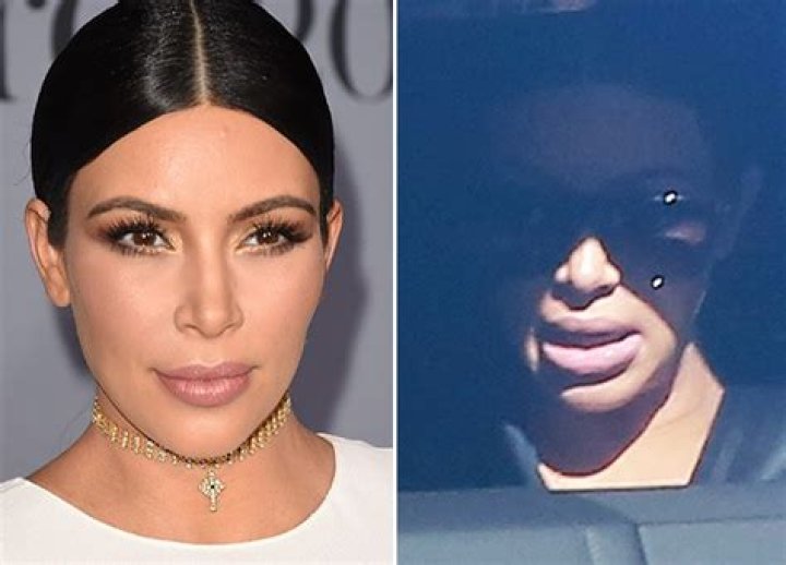 [PIC] Kim Kardashian Lip Fillers — Did She Get Any While Pregnant? – Hollywood Life