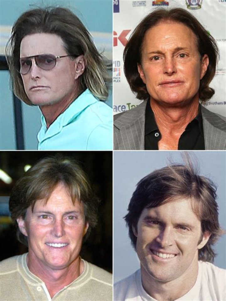 [PICS] Bruce Jenner’s Plastic Surgery — A Scary Facial Transformation – Hollywood Life