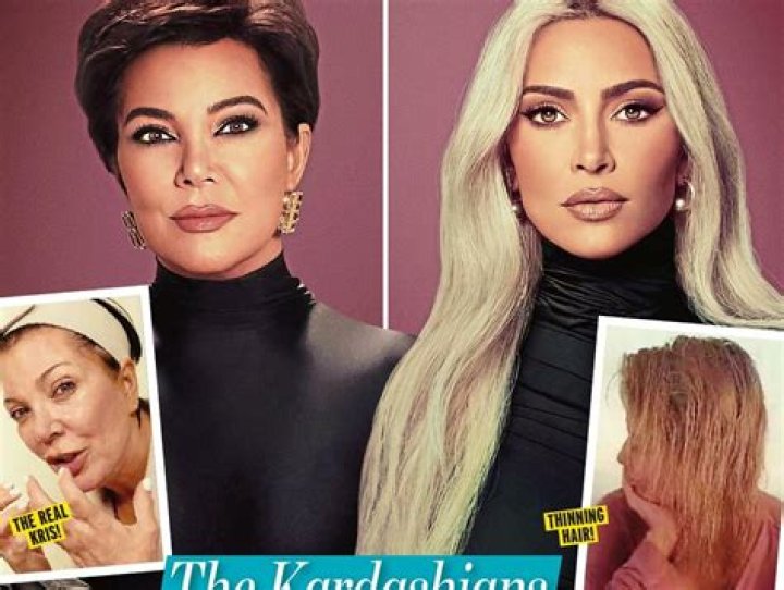 [PICS] Kim Kardashian’s Hair Loss — Is She Going Bald After Bleaching Blonde? – Hollywood Life