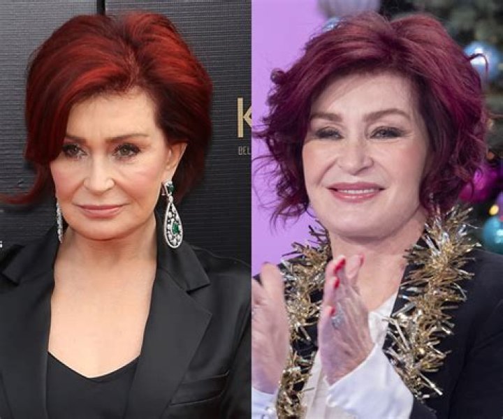 Plastic Surgeon Says If 4 Is Too Many – Hollywood Life