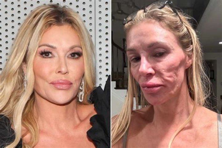 ‘RHOBH’: Brandi Glanville Hints That A Housewife May Quit After ‘Intense’ Fight: She’s ‘Refusing To Film’