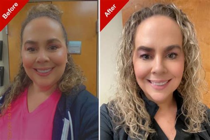 See Before & After Pics – Hollywood Life