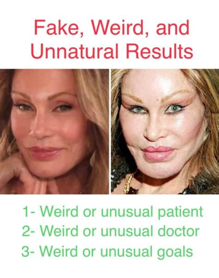Shocking & Unnatural Results On Instagram – Hollywood Life