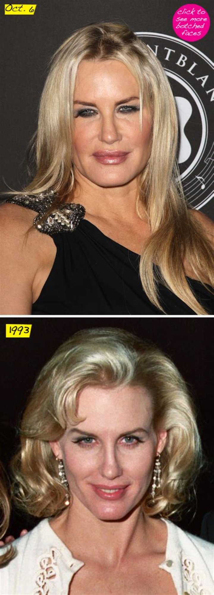 THE NEWEST BOTCHED FACE! Top Plastic Surgeons Say Daryl Hannah Has Had Fillers In Her Lips, Checks, AND A Possible Nose Job! – Hollywood Life