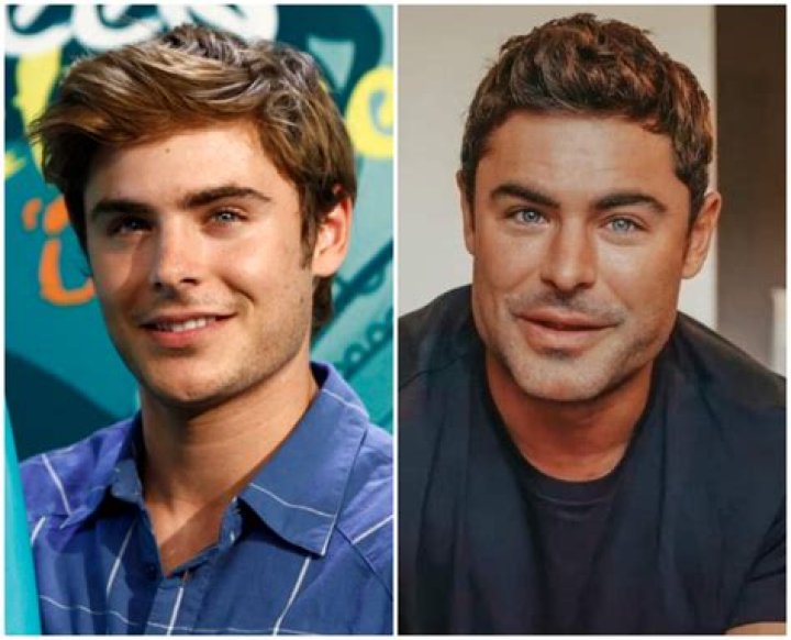 Zac Efron Confirms He ‘Bounced Back’ After He Was Rushed To Hospital For Serious Illness